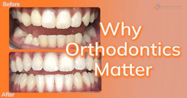 Kolen_Email-November-24